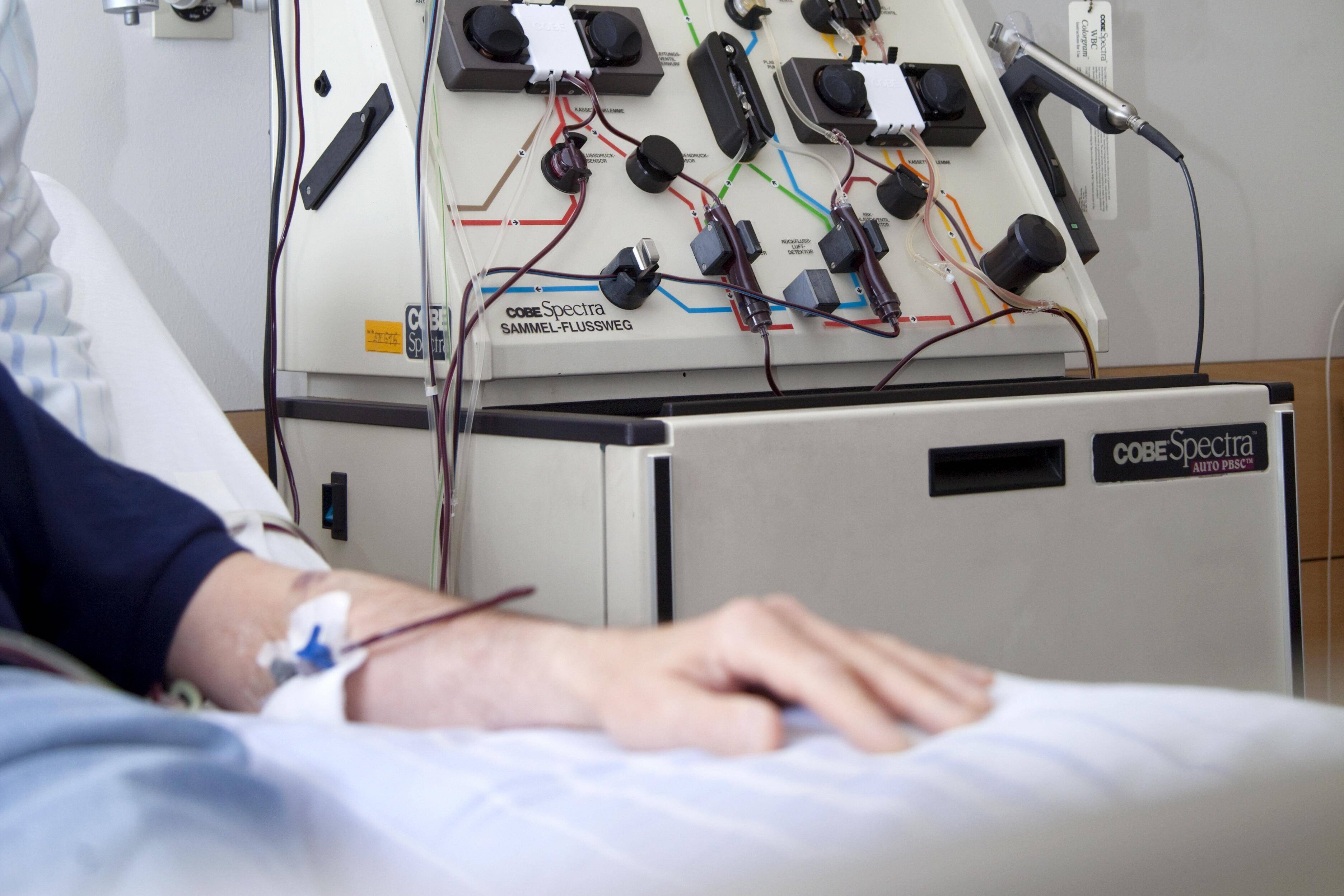 Stammzellentransplantation Ein Patient bei einer Stammzellentransplantation, hier in einem Krankenhaus in Essen, NRW. Die Person liegt im Bett in einem Krankenhauszimmer und hat einen Zugang im Arm.